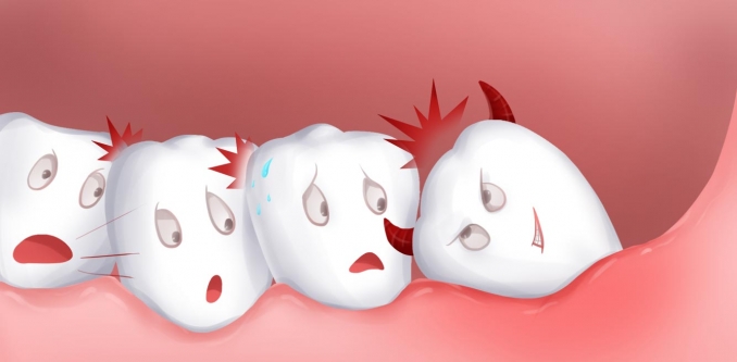 口腔潰瘍4大原因